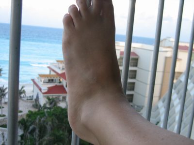 Ick.