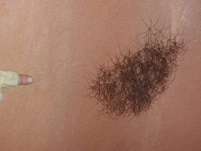A hairy armpit spider-ball. These were all over the...
